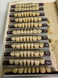 Another Estate Oddity Teeth!  Dentist Sample Teeth From Days Gone By