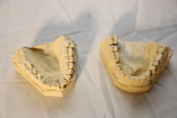 LOT 147 - TEETH MOLDS