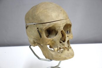 Antique Human Medical Skull