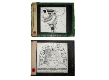 2 Antique Medical Glass Slides: Teeth