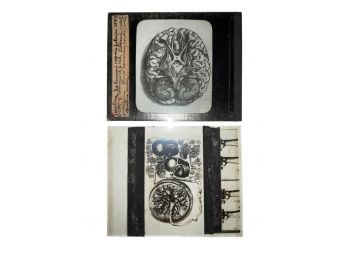 Pair Of Antique Medical Glass Slides: Brain & ?