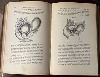 C.1893 Clinical Gynaecology & C.1922 Sex Searchlights & Sane Sex Ethics Books