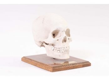 Plaster Replica Of Human Male Skull