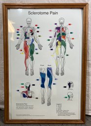 Sclerotome Pain Poster